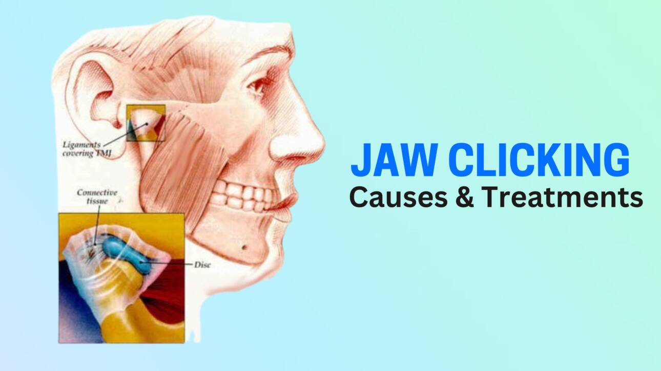 jaw clicking