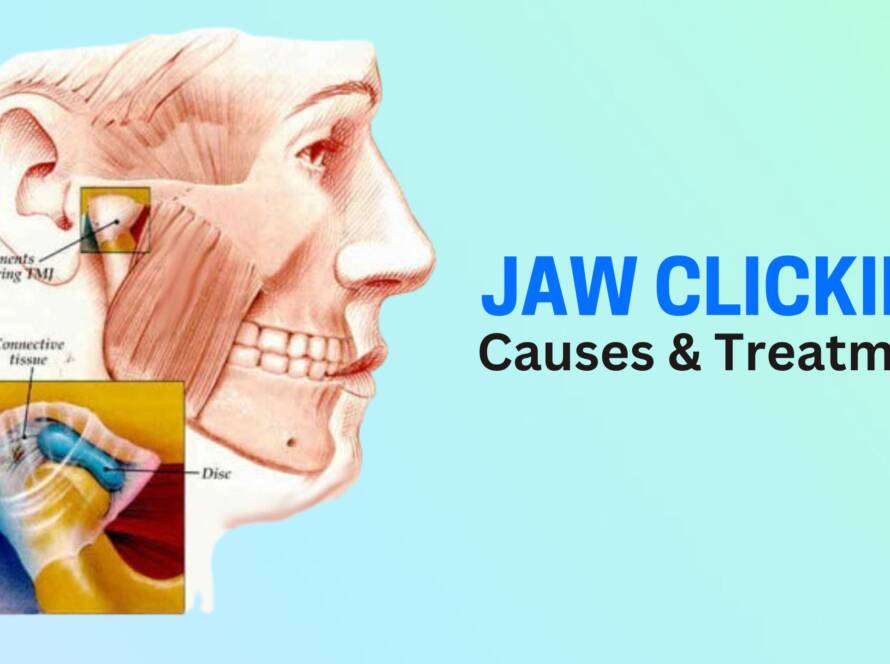 jaw clicking