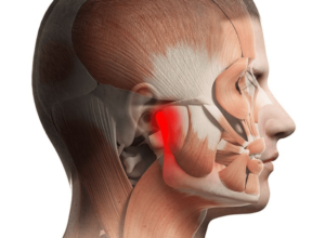 tmj disorder