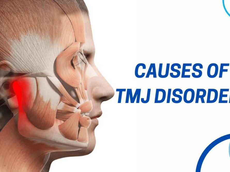 causes of TMJ Disorder