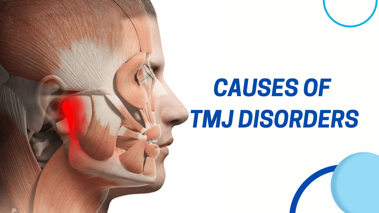 causes of TMJ Disorder