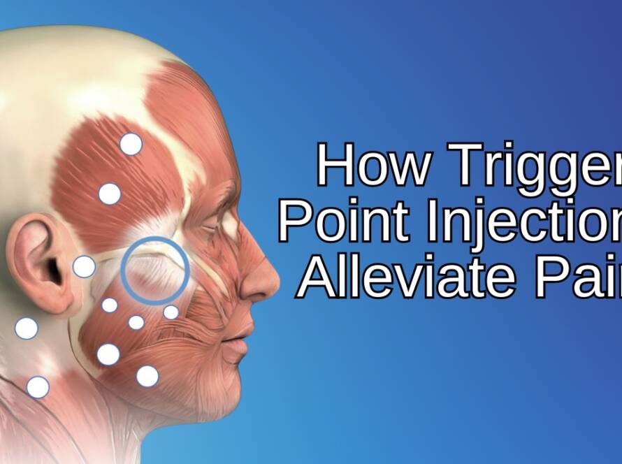 How Trigger Point Injections Alleviate Pain