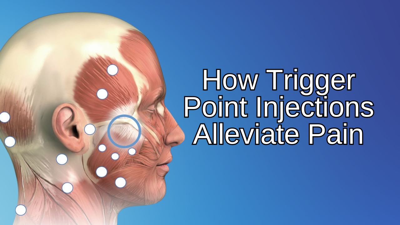 How Trigger Point Injections Alleviate Pain