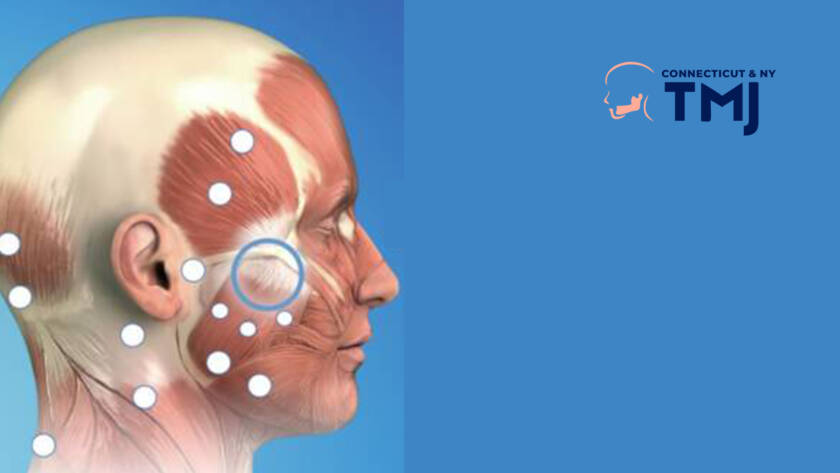 How Trigger Point Injections Alleviate Pain