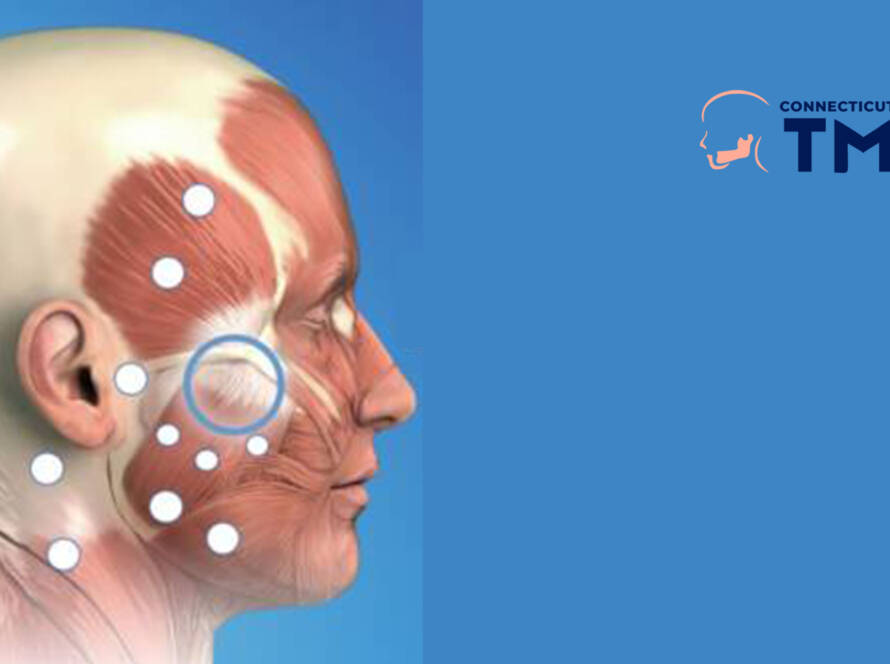 How Trigger Point Injections Alleviate Pain